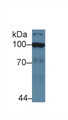 Western Blot; Sample: Human Jurkat cell lysate; Primary Ab: 5µg/ml Rabbit Anti-Human HK2 Antibody Second Ab: 0.2µg/mL HRP-Linked Caprine Anti-Rabbit IgG Polyclonal Antibody