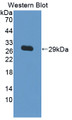 Western Blot; Sample: Recombinant protein.