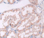 Interleukin 17D (Il17D) Polyclonal Antibody, Cat#CAU23419