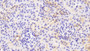 DAB staining on IHC-P; Samples: Mouse Kidney Tissue;  Primary Ab: 20μg/ml Rabbit Anti-Mouse SCNN1a Antibody Second Ab: 2µg/mL HRP-Linked Caprine Anti-Rabbit IgG Polyclonal Antibody 