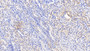 DAB staining on IHC-P; Samples: Human Kidney Tissue;  Primary Ab: 20μg/ml Rabbit Anti-Human SCNN1a Antibody Second Ab: 2µg/mL HRP-Linked Caprine Anti-Rabbit IgG Polyclonal Antibody 