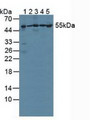 Western Blot; Sample: Lane1: Human Lung Tissue; Lane2: Mouse Brain Tissue; Lane3: Human A549 Cells; Lane4: Human Hela Cells; Lane5: Human Jurkat Cells.