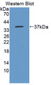 Western Blot; Sample: Recombinant HCCS, Human.