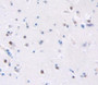 Cytochrome B-245 Beta Polypeptide (Cybb) Polyclonal Antibody, Cat#CAU23440