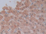 DAB staining on IHC-P; Samples: Human Liver Tissue;  Primary Ab: 10µg/ml Rabbit Anti-Human CYP3A4 An