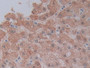 DAB staining on IHC-P; Samples: Human Liver Tissue