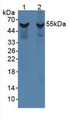 Western Blot; Sample: Lane1: Rat Liver Tissue; Lane2: Mouse Liver Tissue.