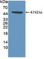 Western Blot; Sample: Recombinant CDK8, Human.