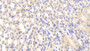 DAB staining on fromalin fixed paraffin- embedded spleen tissue)