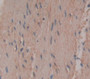 Troponin T Type 3, Fast Skeletal (Tnnt3) Polyclonal Antibody, Cat#CAU23460