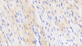 DAB staining on IHC-P; Samples: Porcine Cardiac Muscle Tissue;  Primary Ab: 20μg/ml Rabbit Anti-Porcine TNNT2 Antibody Second Ab: 2µg/mL HRP-Linked Caprine Anti-Rabbit IgG Polyclonal Antibody 