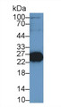 Western Blot; Sample: Mouse Skeletal muscle lysate; Primary Ab: 1µg/ml Rabbit Anti-Rat TNNI2 Antibody Second Ab: 0.2µg/mL HRP-Linked Caprine Anti-Rabbit IgG Polyclonal Antibody