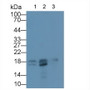 Western Blot; Sample: Lane1: Porcine Skeletal muscle lysate; Lane2: Mouse Skeletal muscle lysate; Lane3: Mouse Eye lysate;; Primary Ab: 1µg/mL Rabbit Anti-Human TNNC2 Antibody; Second Ab: 0.2µg/mL HRP-Linked Caprine Anti-Rabbit IgG Polyclonal Antibody;