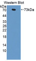 Western Blot; Sample: Recombinant protein.