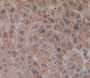 Lipase, Monoacylglycerol (Mgl) Polyclonal Antibody, Cat#CAU23479