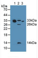 Western Blot; Sample: Lane1: Human Serum; Lane2: Mouse Heart Tissue; Lane3: Human Liver Tissue.