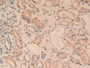 DAB staining on IHC-P; Samples: Human Kidney Tissue.