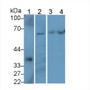 Western Blot; Sample: Lane1: Rat Cerebrum lysate; Lane2: HepG2 cell lysate; Lane3: Hela cell lysate; Lane4: MCF7 cell lysate; Primary Ab: 2µg/ml Rabbit Anti-Human SQSTM1 Antibody; Second Ab: 0.2µg/mL HRP-Linked Caprine Anti-Rabbit IgG Polyclonal Antibody;
