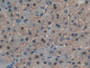 DAB staining on IHC-P; Samples: Human Liver Tissue.