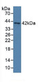 Western Blot; Sample: Human Serum.