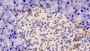 DAB staining on fromalin fixed paraffin- embedded stomach tissue)