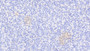 DAB staining on fromalin fixed paraffin- embedded pancreas tissue)