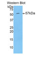 Western Blot; Sample: Recombinant protein.