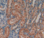 N-Acetyl Alpha-D-Glucosaminidase (Naglu) Polyclonal Antibody, Cat#CAU23524