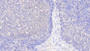 DAB staining on IHC-P; Samples: Human Lymph node Tissue;  Primary Ab: 20μg/ml Rabbit Anti-Human S100Z Antibody Second Ab: 2µg/mL HRP-Linked Caprine Anti-Rabbit IgG Polyclonal Antibody 