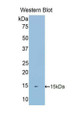 Western Blot; Sample: Recombinant protein.