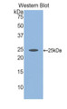 Western Blot; Sample: Recombinant protein.