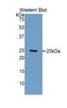 Western Blot; Sample: Recombinant protein.