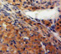 Used in DAB staining on fromalin fixed paraffin-embedded Ovary tissue