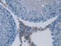 DAB staining on IHC-P; Samples: Rat Testis Tissue)