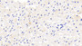 DAB staining on IHC-P; Samples: Human Cardiac Muscle Tissue;  Primary Ab: 20μg/ml Rabbit Anti-Human COL14 Antibody Second Ab: 2µg/mL HRP-Linked Caprine Anti-Rabbit IgG Polyclonal Antibody 