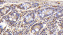 DAB staining on IHC-P; Samples: Human Small intestine Tissue; Primary Ab: 30µg/ml Rabbit Anti-Human CD3e Antibody Second Ab: 2µg/mL HRP-Linked Caprine Anti-Rabbit IgG Polyclonal Antibody