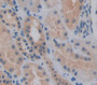 Hedgehog Homolog, Indian (Ihh) Polyclonal Antibody, Cat#CAU23554