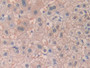 DAB staining on IHC-P; Samples: Human Liver Tissue; Primary Ab: 30µg/ml Rabbit Anti-Human DHH Antibody Second Ab: 2µg/mL HRP-Linked Caprine Anti-Rabbit IgG Polyclonal Antibody