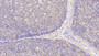 DAB staining on IHC-P; Samples: Human Lymph node Tissue; Primary Ab: 20μg/ml Rabbit Anti-Human TAP2 Antibody Second Ab: 2µg/mL HRP-Linked Caprine Anti-Rabbit IgG Polyclonal Antibody