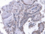 DAB staining on IHC-P; Samples: Human Thyroid Tissue; Primary Ab: 20µg/ml Rabbit Anti-Human LRP1B Antibody Second Ab: 2µg/mL HRP-Linked Caprine Anti-Rabbit IgG Polyclonal Antibody