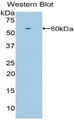 Western Blot; Sample: Recombinant protein.