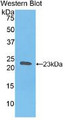 Western Blot; Sample: Recombinant protein.