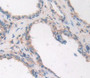 Used in DAB staining on fromalin fixed paraffin- embedded prostate gland tissue