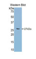 Western Blot; Sample: Recombinant protein.