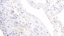 DAB staining on fromalin fixed paraffin- embedded prostate gland tissue)