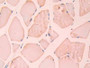 DAB staining on IHC-P; Samples: Rat Skeletal muscle Tissue; Primary Ab: 30µg/ml Rabbit Anti-Rat CA12 Antibody Second Ab: 2µg/mL HRP-Linked Caprine Anti-Rabbit IgG Polyclonal Antibody