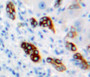 DAB staining on fromalin fixed paraffin-embedded liver tissue)