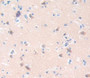 Used in DAB staining on fromalin fixed paraffin- embedded Kidney tissue