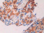 DAB staining on IHC-P; Samples: Mouse Ovary Tissue; Primary Ab: 30µg/ml Rabbit Anti-Mouse CA7 Antibody Second Ab: 2µg/mL HRP-Linked Caprine Anti-Rabbit IgG Polyclonal Antibody