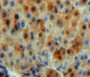 DAB staining on fromalin fixed paraffin-embedded liver tissue)